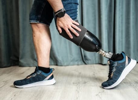 Адаптация после выдачи протеза