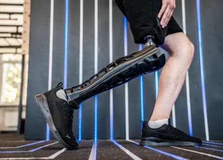 Консультация в центре протезирования ProMotion