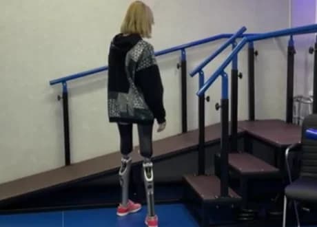 Консультация и сопровождение семьи в детском протезировании