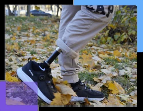 Маршрут получения протеза и консультация по документам